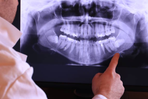 Best Emergency Dental Care for Broken or Chipped Teeth in Whitehouse, TX